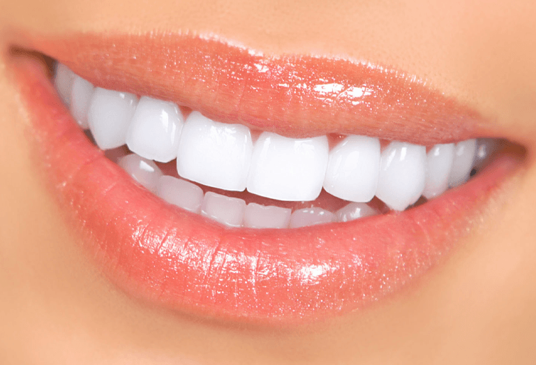 Teeth Whitening Arlington Va
