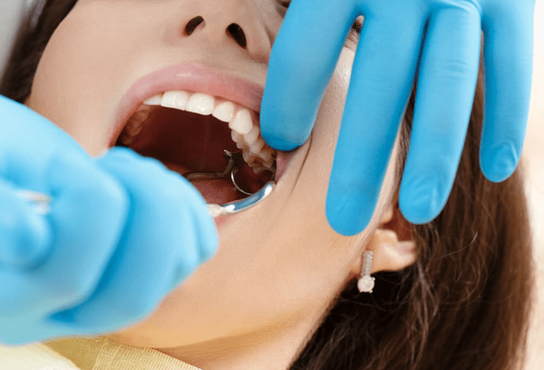 Wisdom Teeth Removal Surgery