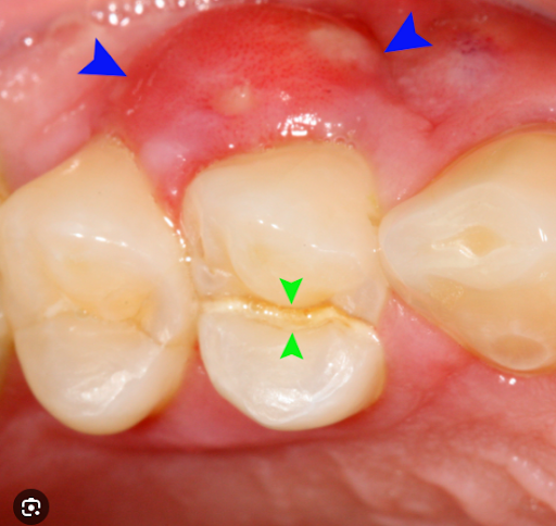 dentist in arlington va